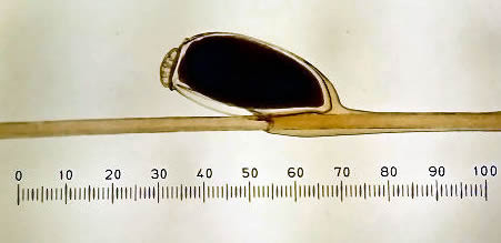 louse egg