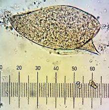 schistosoma egg