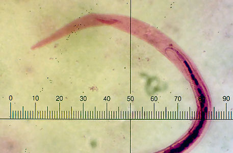 microfilaria ID