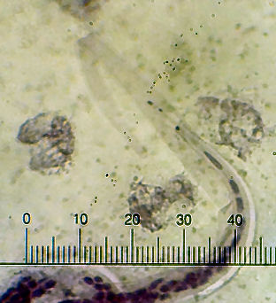 microfilaria ID