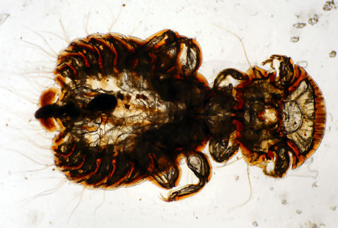 pheasant louse