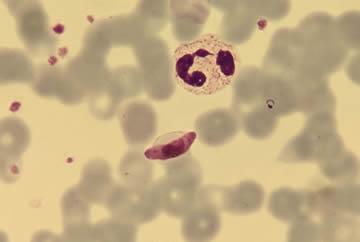 gametocyte-Pf