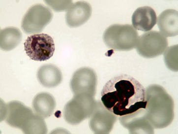 P.ovale-gametocyte