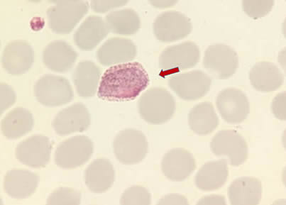 Pv-gametocyte