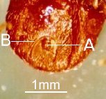 Ixodes ricinus-anal groove above anus