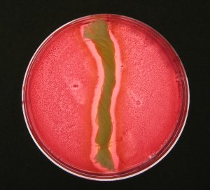 MRSA-inhibition3